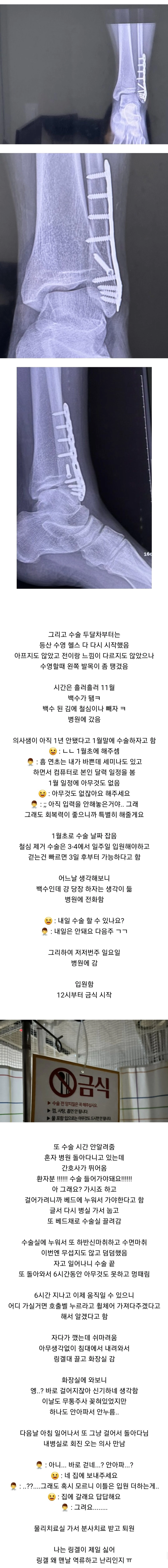 Internet_20231228_235854_4.jpeg 발목 부러졌는데 하나도 안아프다는 여자의 11개월 뒤 근황 ㄷㄷㄷ.JPG
